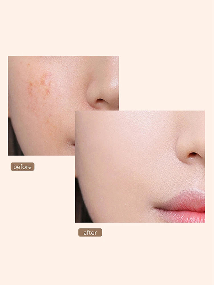 Concealer Face Freckle Foundation Cream To Cover Black Eye Acne Imprint Waterproof Anti Sweat Makeup Before The Base