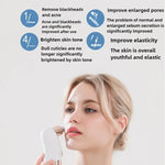 Blackhead Remover Pore Vacuum Face Cleaner Electric Pimple Acne Removal USB Rechargeable Water Cycle Black Dot Remover