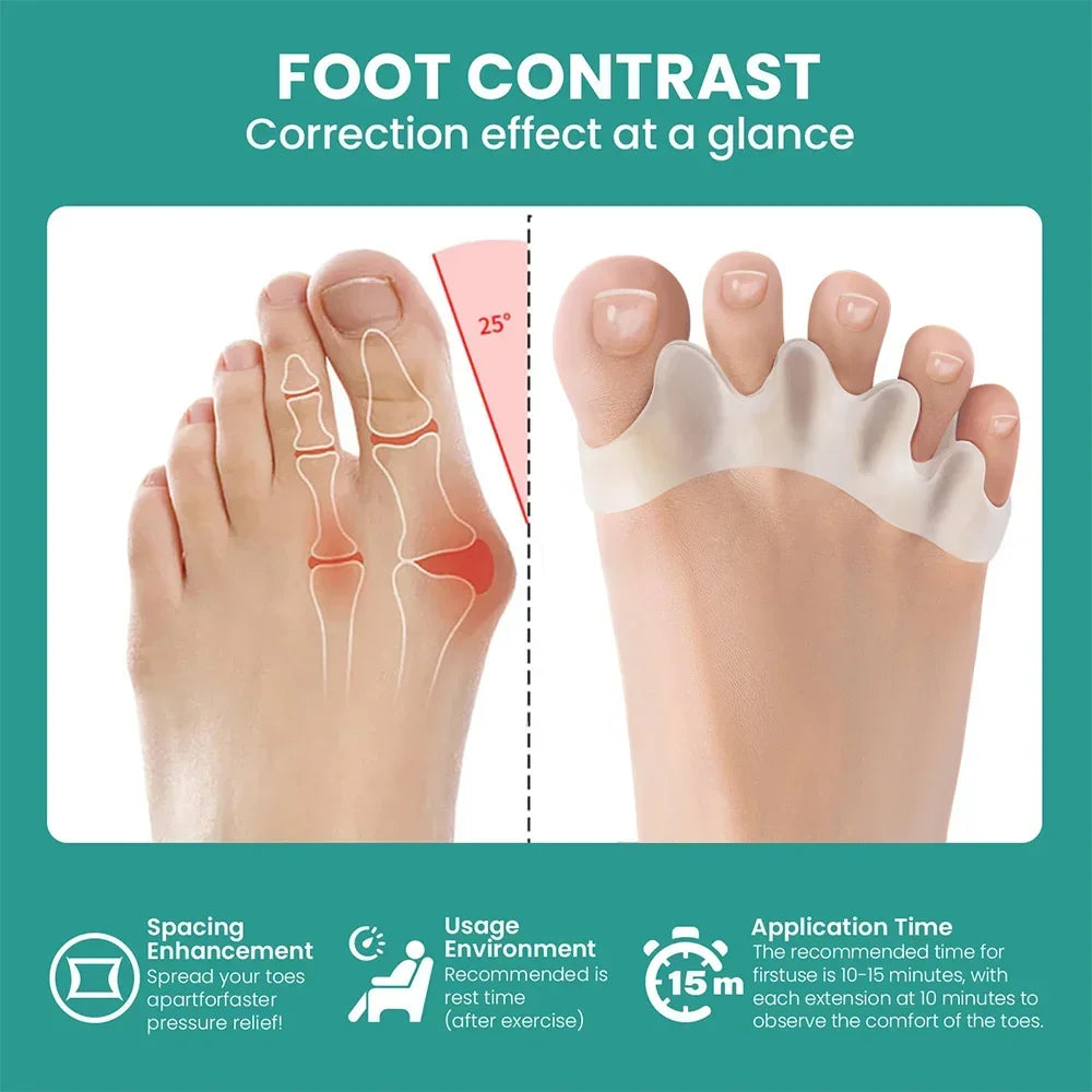 Silicone Toe Separators – Bunion Corrector & Toe Straightener