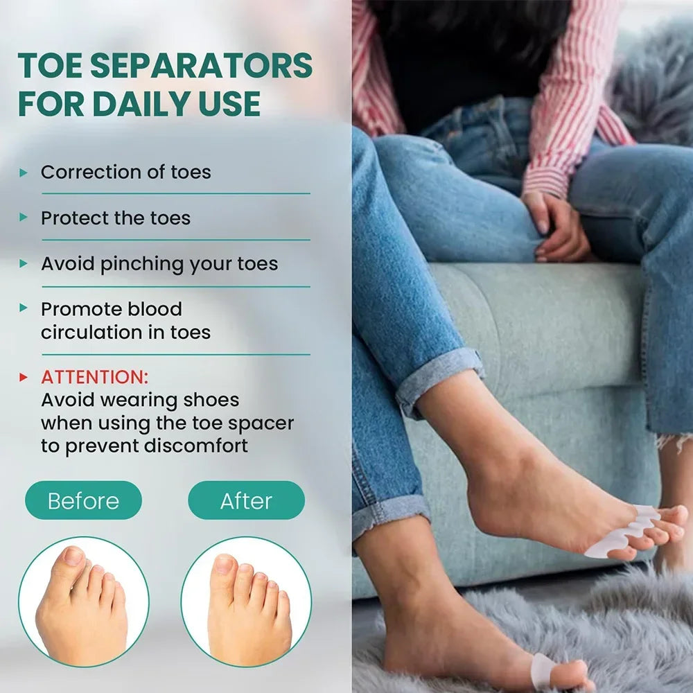 Silicone Toe Separators – Bunion Corrector & Toe Straightener