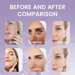 Bakuchiol Face Serum – Anti-Aging & Anti-Wrinkle