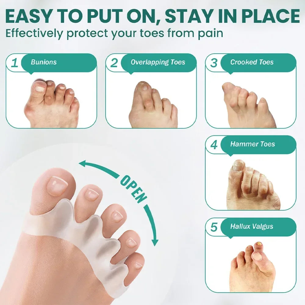 Silicone Toe Separators – Bunion Corrector & Toe Straightener
